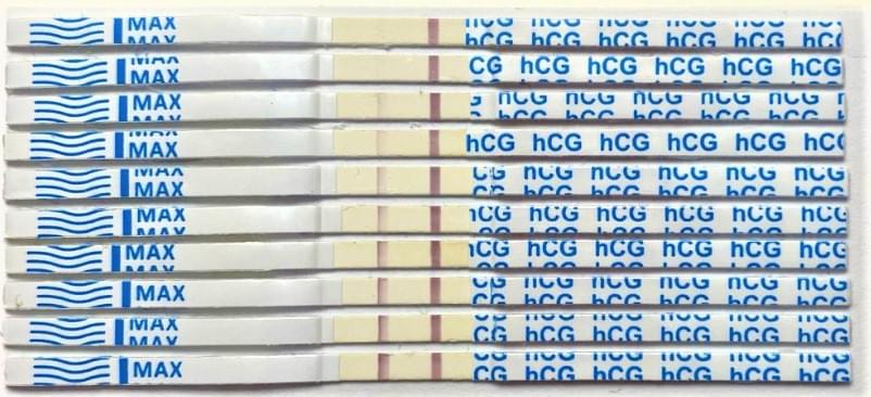 Почему важно вести беременность у специалистов и сдавать анализы